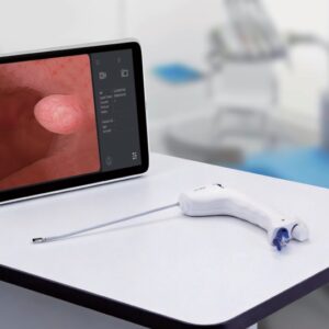 HugeMed Single-use Hysteroscope